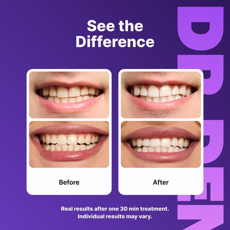 DRDENT Purple Teeth Whitening Strips - 7/21 Whitening Sessions - Non Sensitive Teeth Whitening - Peroxide-Free